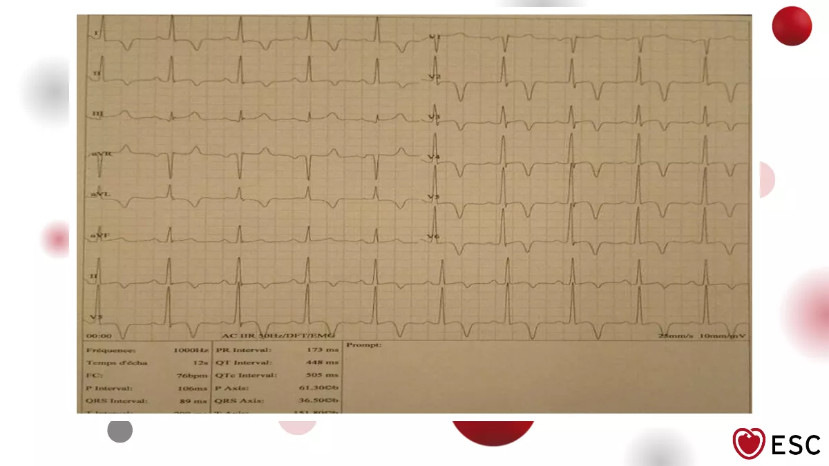 Image of the week 4 February 2026 