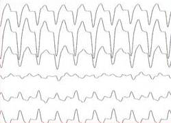 belardinelli-cpx-case-top-right.jpg