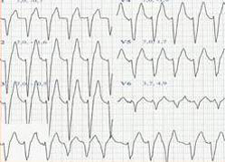 belardinelli-cpx-case-top-left.jpg