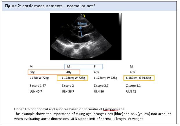 Fig 2 Backer - How to measure the aorta in the setting of genetic aortic disease.jpg