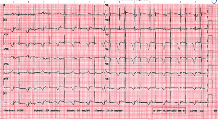 CC Vol 10 Picture6_escardio-Clinical case.png