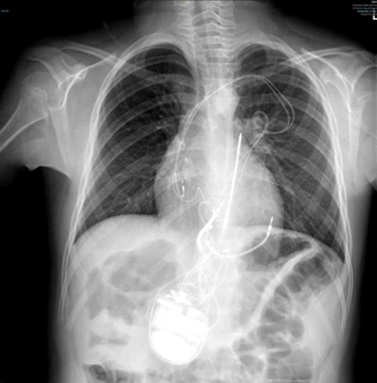 CC Vol 10 Picture4A_Clinical case.png