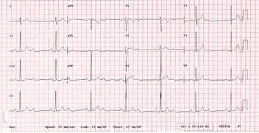quiz-may-case-quiz_escardio-hPhotoMedium.jpg