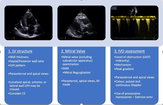 Figure 1 - How to measure intraventricular obstruction in hypertrophic cardiomyopathy.jpg