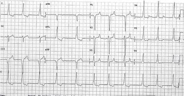 ecg-quiz-jan-2015_escardio-hPhotoMedium.jpg