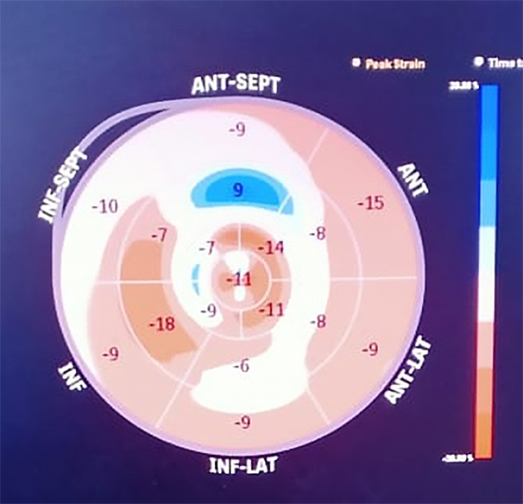 243_Sachdeva_Figure 2_How do you answer a 20-year-old when they ask can I participate in competitive sports.jpg