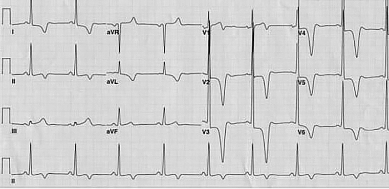 243_Sachdeva_Figure 1_How do you answer a 20-year-old when they ask can I participate in competitive sports.jpg