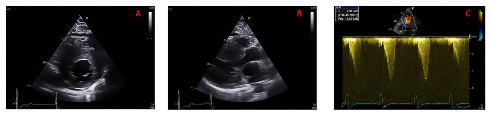 380_Piriou_Figure 1.jpg