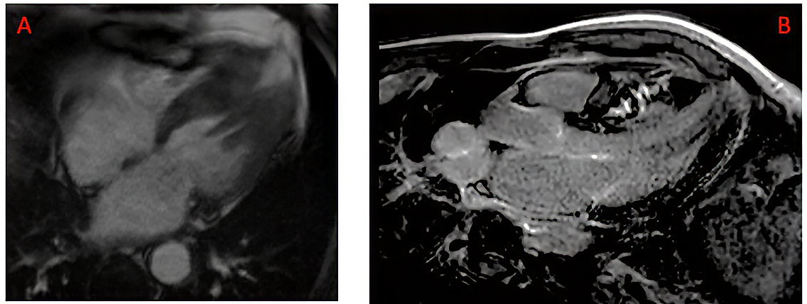 380_Piriou_Figure 2.jpg