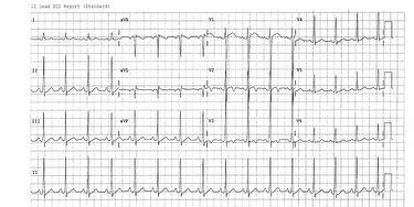 ecg-quiz-dec-2014-case-image_escardio-hPhotoMedium.jpg