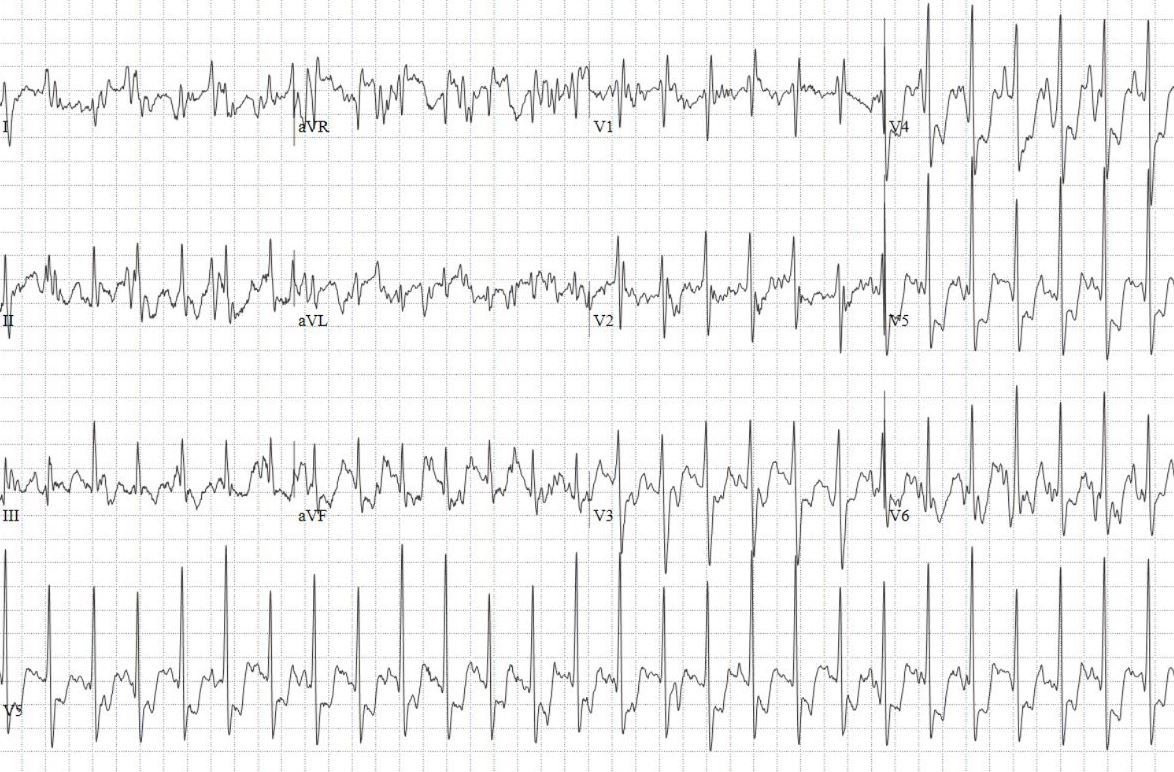 2023-01-Quiz-Figure-2.jpg