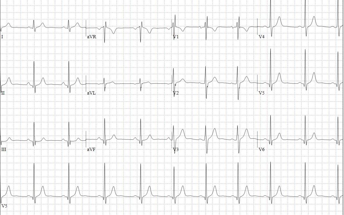 2023-01-Quiz-Figure-1.jpg
