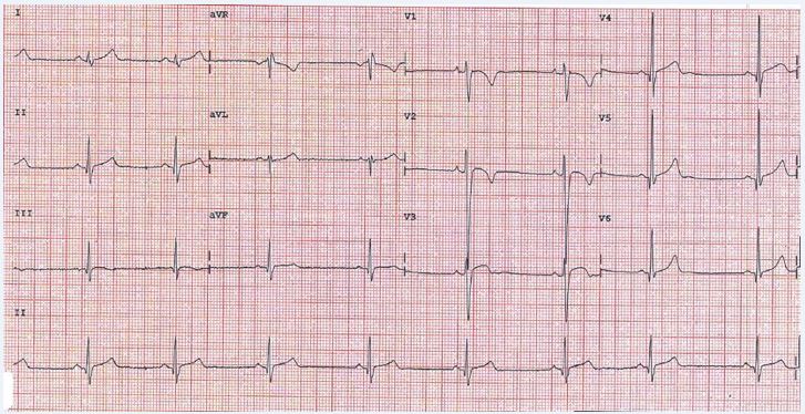 2019-07-case-ECG-figure1.jpg