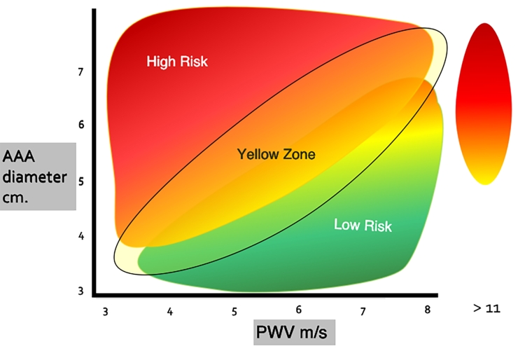227_Russo_Figure 1_A new diagram and index to assess the risk of rupture of abdominal aortic aneurysms.jpg