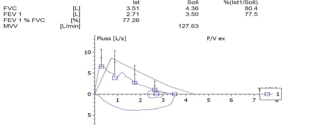 spirometry-cpx-may-2018-case2.jpg