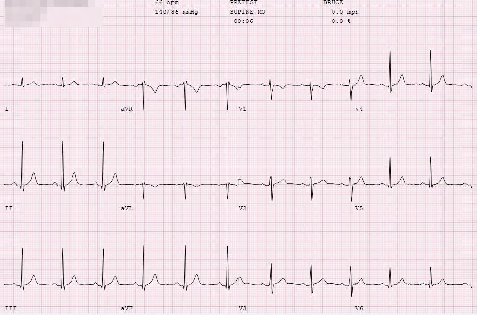 2020-sports-cardiology-case11-image1.jpg