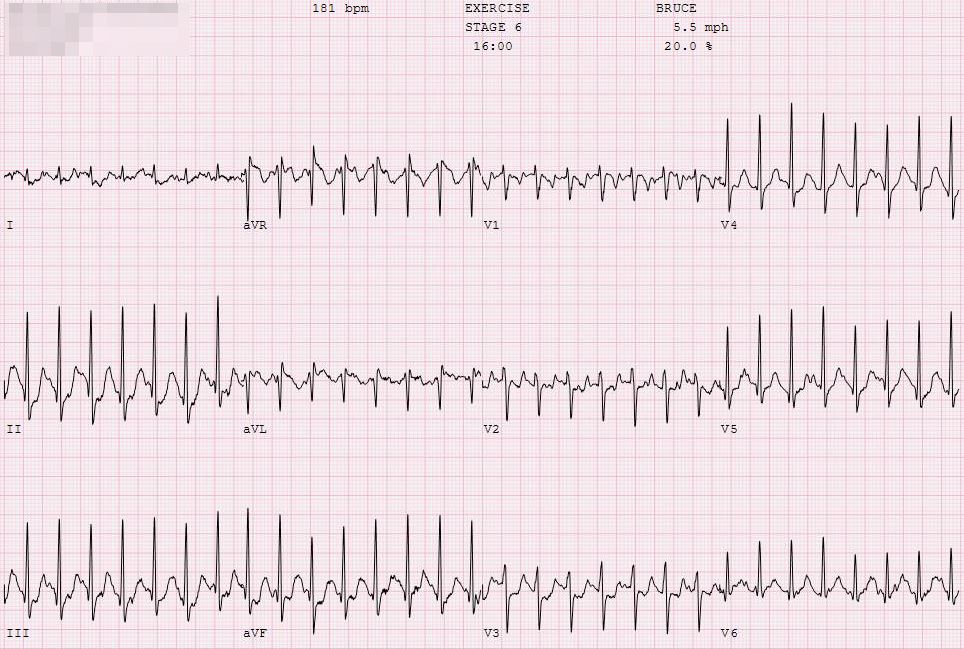 2020-sports-cardiology-case11-image2.jpg