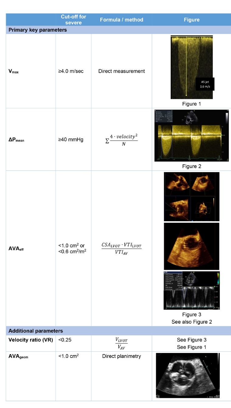 214_De Chiara_Table 1_V2._The value of echocardiography in aortic valve disease the essentials.jpg