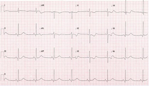 case_image_ECG_March2016_V2.jpg