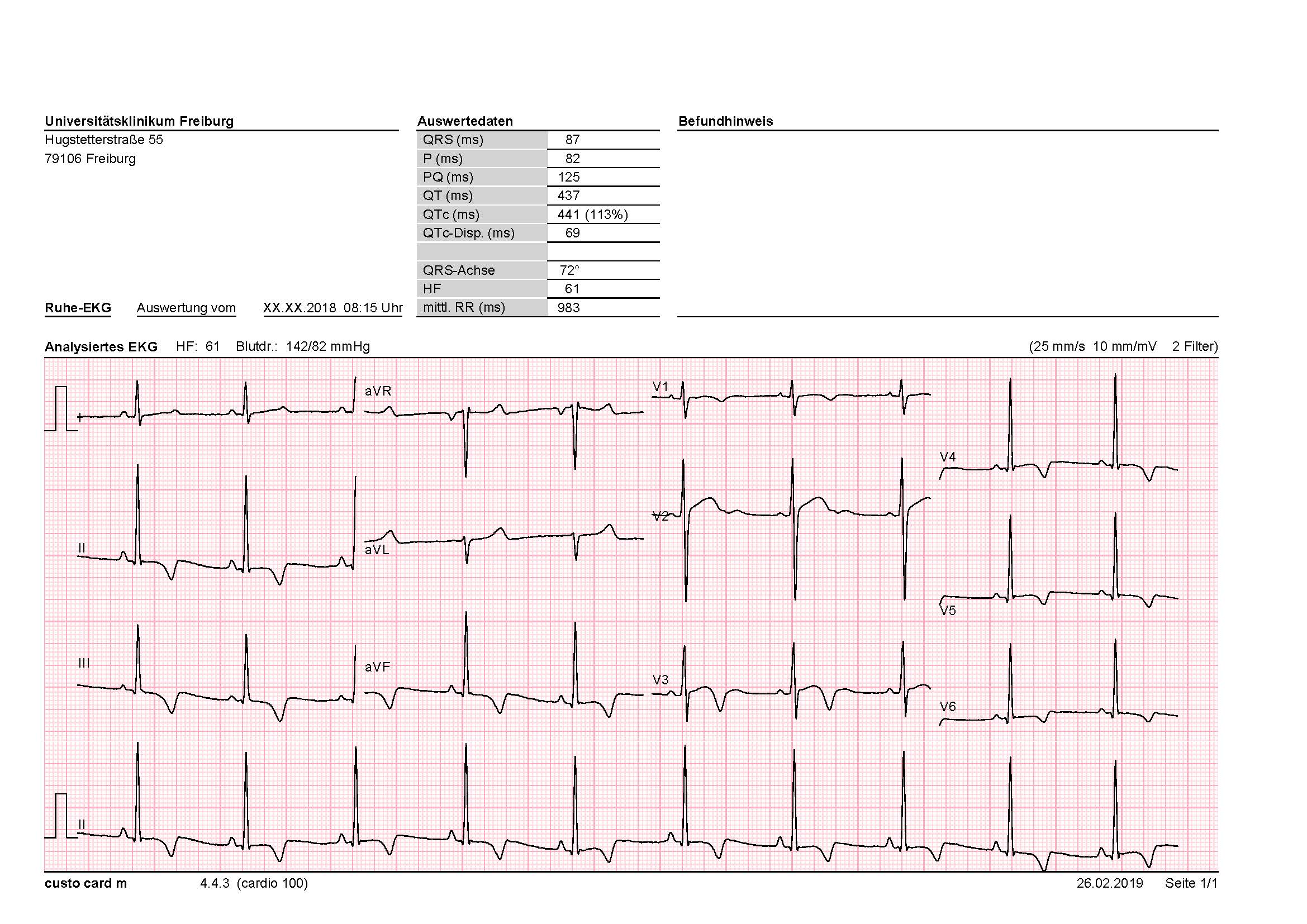ECG case April2019-1.jpg