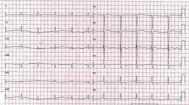 june-case-quiz_escardio-hPhotoMedium.jpg