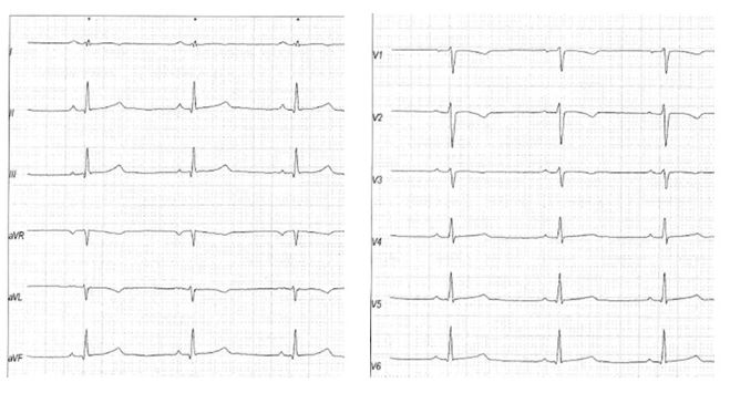 2019-12-quiz7-Figure-1.jpg