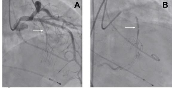 Fig 2 CC - Clinical Case - hypertrophic cardiomyopathy.jpg