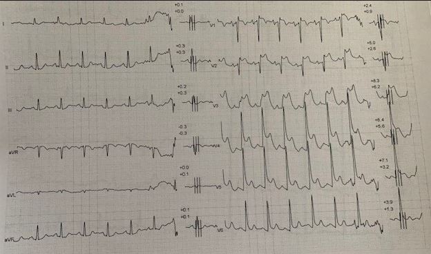Quiz-2023-Jan-Fig2.jpg