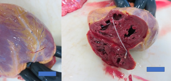 Clinical case_ Fig 5 - The importance of early etiologic diagnosis of dilated cardiomyopathy.png