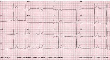 sc-quiz-nov-14-case-image_escardio-hPhotoMedium.jpg