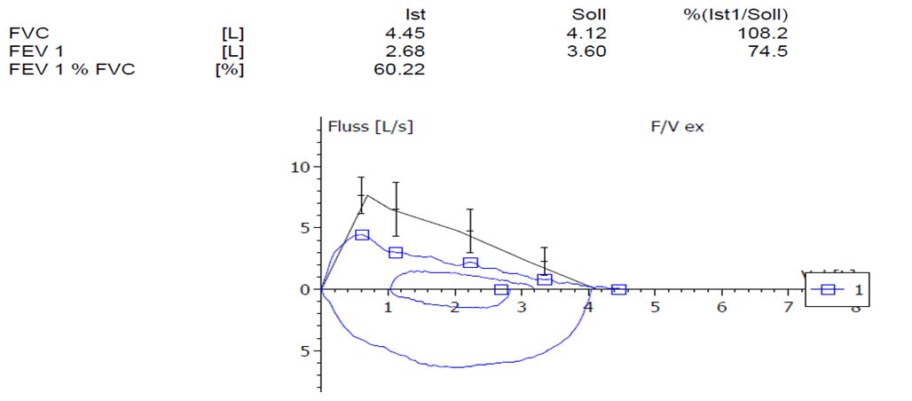 spirometry-cpx-may-2018-case1.jpg