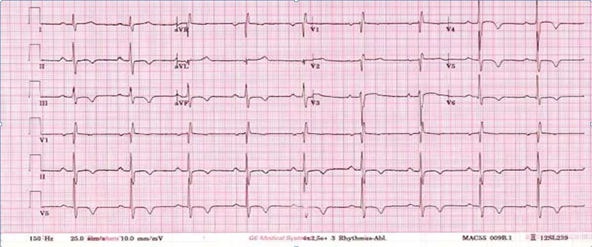 ecg-cpx-may-2018-case4.jpg