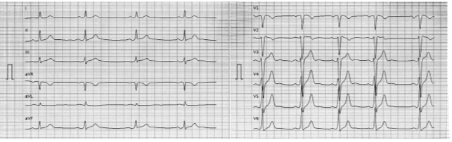 Electrocardiogram Figure 2 - a pleiotropic approach is mandatory.png