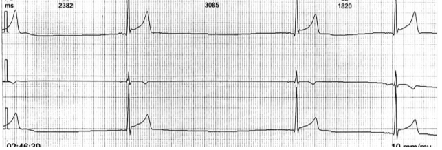 Holter monitoring Figure 3 - a pleiotropic approach is mandatory.png