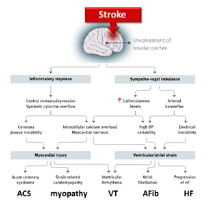 213_Doehner_Figure 2_Stroke as interdisciplinary disease.jpg