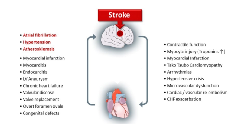 213_Doehner_Figure 1_Stroke as interdisciplinary disease.jpg