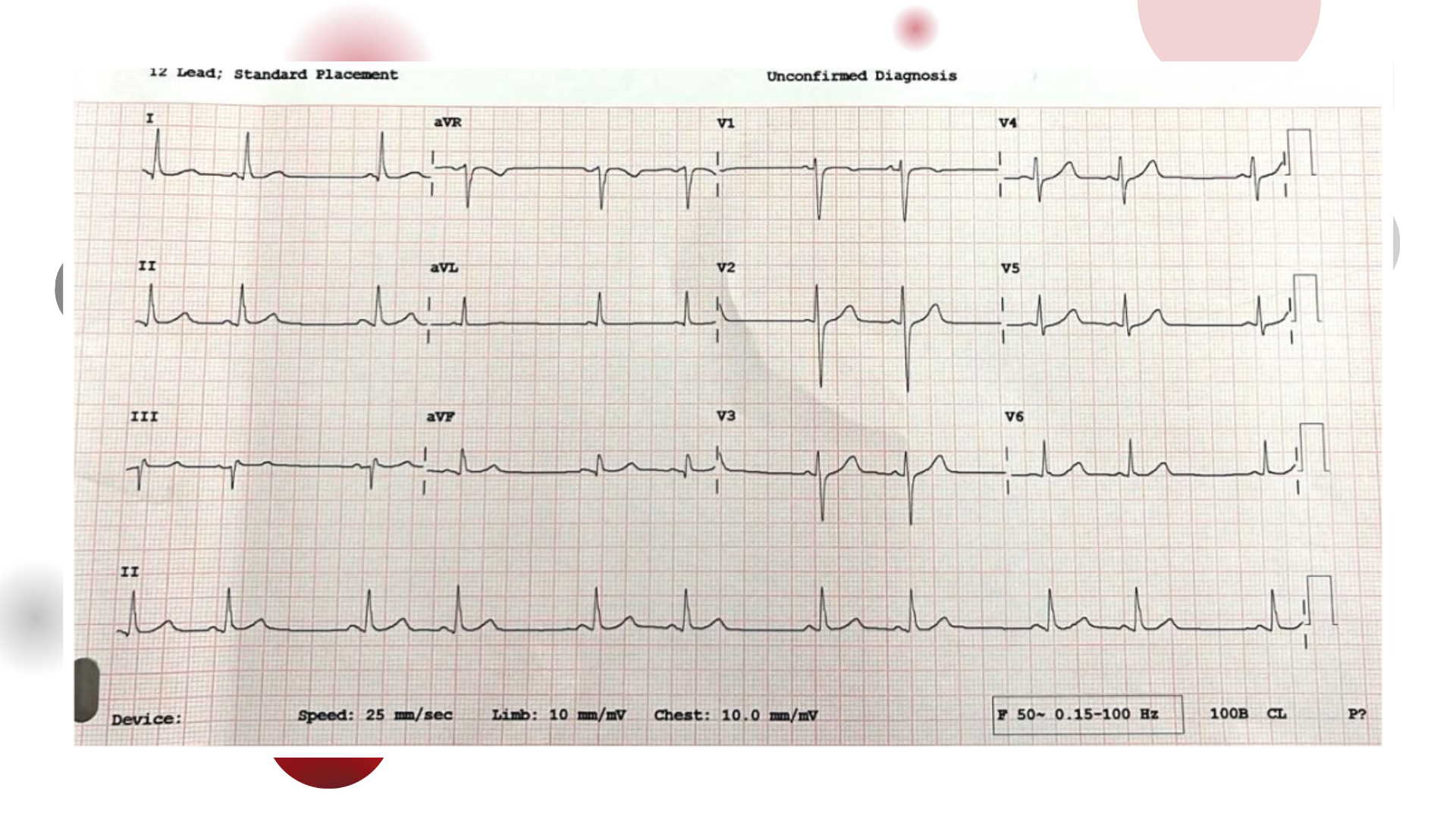 Image of the week 22 April 2026