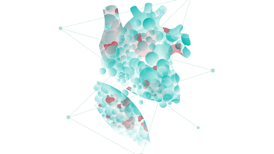 Aorticare visual